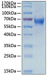 Recombinant Human IL-6RA/CD126 Protein (RP00269)