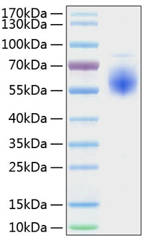 Recombinant Human IL1RL1/ST2 Protein