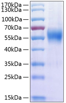 Recombinant Human IL-17RA/CD217 Protein