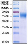 Recombinant Human IL-17RA/CD217 Protein (RP00273)