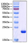 Recombinant Human Retinol-binding protein 4/PRBP Protein (RP00274)