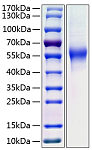 Recombinant Human CD46 Protein (RP00279)
