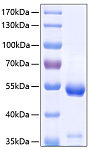 Recombinant Human Carboxypeptidase E/CPE Protein (RP00281)