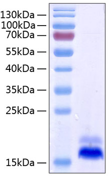 Recombinant Human TNFRSF10B/DR5/TRAIL-R/2CD262 Protein