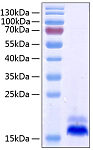 Recombinant Human TNFRSF10B/DR5/TRAIL-R/2CD262 Protein (RP00282)