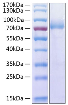 Recombinant Human DNAM-1/CD226 Protein