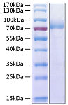 Recombinant Human DNAM-1/CD226 Protein (RP00283)