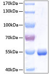 Recombinant Human Retinol-binding protein 4/PRBP Protein (RP00284)