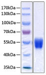 Recombinant Human Serpin A1/Alpha-1-antitrypsin Protein (RP00287)