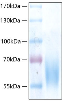 Recombinant Human Trk-B/NTRK2 Protein