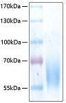 Recombinant Human Trk-B/NTRK2 Protein (RP00290)