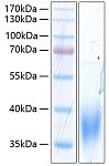 Recombinant Human SLAMF7/CD319 Protein (RP00292)