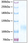Recombinant Human SELE/E-selectin/CD62E  Protein (RP00293)