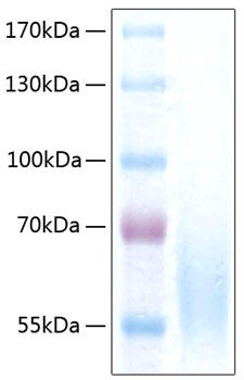 Recombinant Human CEACAM-1/CD66a Protein