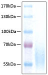 Recombinant Human CEACAM-1/CD66a Protein (RP00294)
