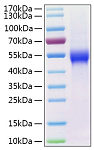 Recombinant Human uPAR/PLAUR/CD87 Protein (RP00295)