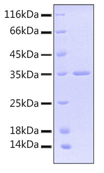 Recombinant Human TACTILE/CD96 Protein