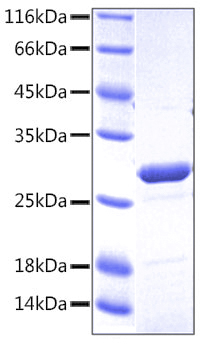 Recombinant Human TNFRSF1B/TNF-R2/CD120b Protein