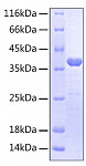 Recombinant Human IL-2RB/CD122 Protein (RP00407)