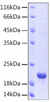 Recombinant Human 5'-Nucleotidase/NT5E/CD73 Protein