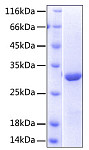 Recombinant Human NKG2-D/KLRK1/CD314 Protein (RP00417)