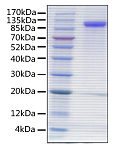 Recombinant Human Siglec-4a/MAG Protein (RP00424)