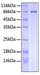 Recombinant Human R-spondin-3 Protein (RP00439)