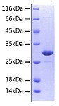 Recombinant Human TNFRSF11A/CD265 Protein (RP00458)