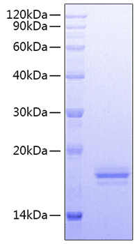 Recombinant Human Fc-epsilon RI-alpha/FCER1A Protein
