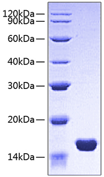 Recombinant Human FABP3/H-FABP Protein