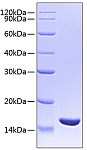 Recombinant Human TNF-beta/LT-alpha Protein (RP00506)