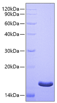 Recombinant Human CD44 Protein