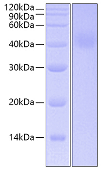 Recombinant Human IL-20RA Protein