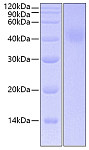 Recombinant Human IL-20RA Protein (RP00537)