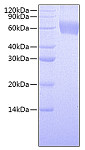 Recombinant Human CSF2RA/GMCSFR-alpha/CD116 Protein (RP00563)
