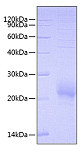 Recombinant Human BY55/CD160 Protein (RP00566)