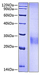 Recombinant Human KP43/CD94 Protein (RP00567)