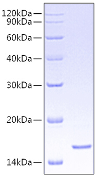 Recombinant Human CD5 Protein
