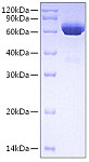Recombinant Human tPA/Tissue-type plasminogen activator/PLAT Protein (RP00595)