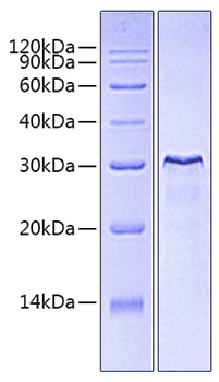 Recombinant Human CD3E&CD3D Protein