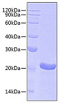 Recombinant Human Ferritin heavy chain/FTH1 Protein (RP00631)