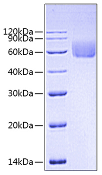 Recombinant Human IL-31 Protein