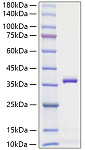 Recombinant Mouse Apolipoprotein E/APOE Protein (RP00640)