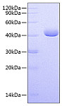 Recombinant Human Nectin-4 Protein (RP00642)