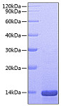 Recombinant Mouse Beta-NGF Protein (RP00667)