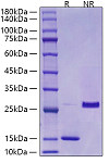 Recombinant Mouse/Rat Mature TGF-beta 1 Protein (RP00671)