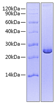 Recombinant Mouse/Rat Mature TGF-beta 2 Protein