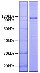 Recombinant Human IL12RB1/CD212 Protein (RP00675)