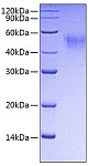 Recombinant Mouse Fc-gamma RI/CD64 Protein (RP00710)