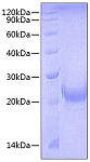 Recombinant Mouse TNFSF4/OX40 ligand/CD252 Protein (RP00713)